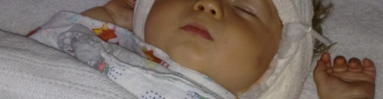 Harry after the operation