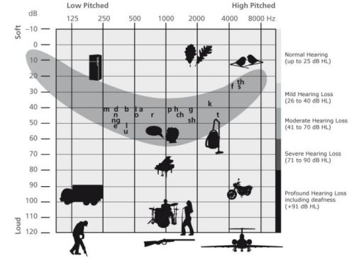 Hearing chart - where speech and environmental sounds are accessed